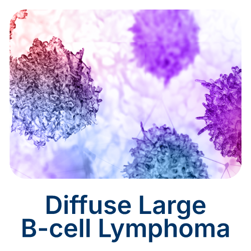 Diffuse Large B-Cell Lymphoma