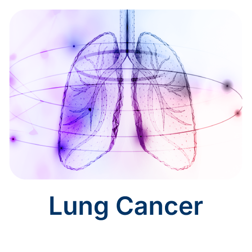 Lung Cancer